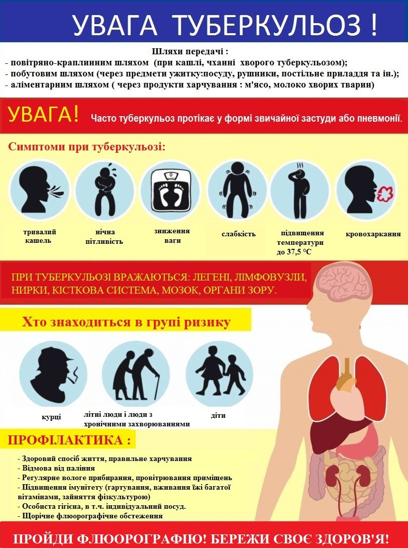 Профілактика туберкульозу - Міська поліклініка № 19