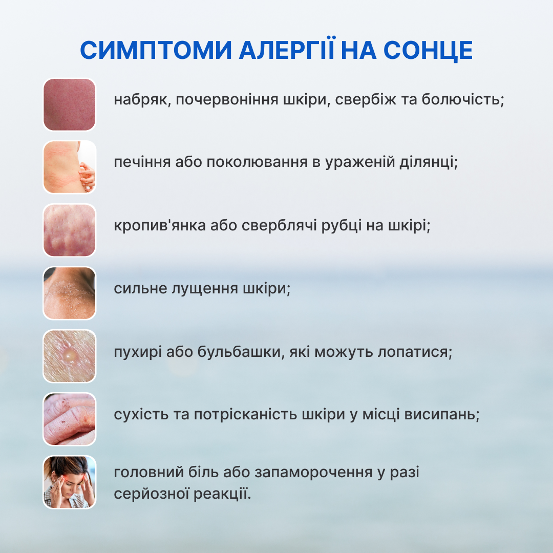 Що варто знати про алергію | Центр громадського здоров'я