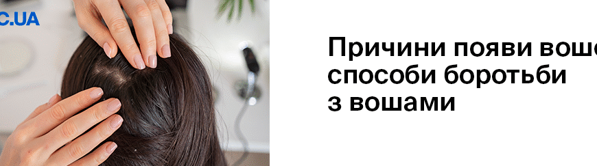 Звідки беруться воші у дітей: основні причини та способи профілактики