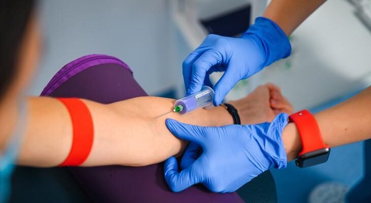 Загальний аналіз крові: звідки беруть зразки та що варто знати для точності?