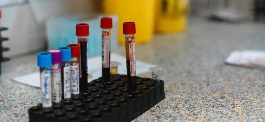 Аналіз «харчова панель»: кому він потрібен і чому це важливо знати?