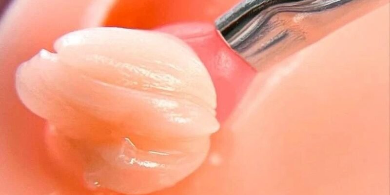 Догляд за шкірою навколо губ: ключ до збереження молодості та краси