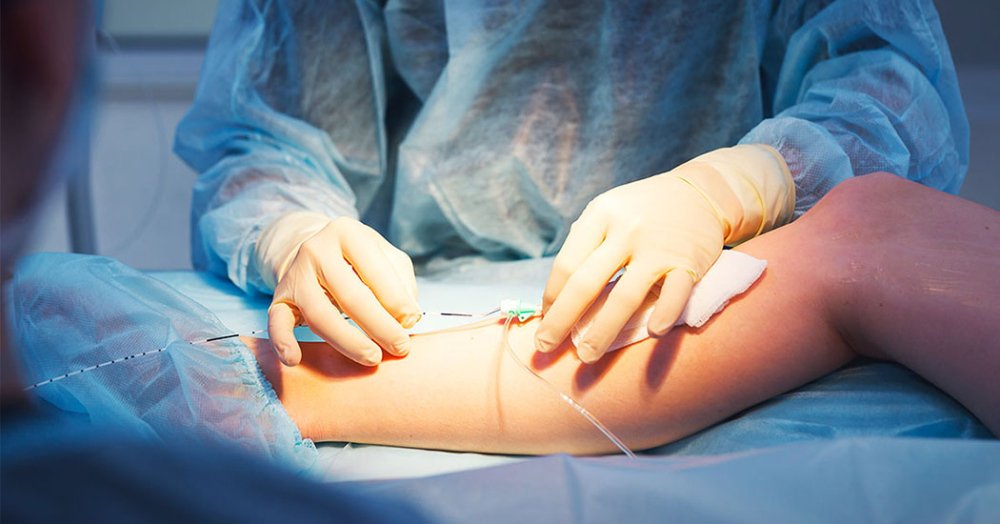 Ангіохірург