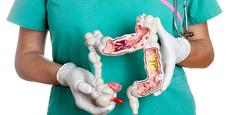 Консультація з проктологом онлайн: які питання важливо задати лікарю? Консультація з проктологом онлайн: які питання важливо задати лікарю?
