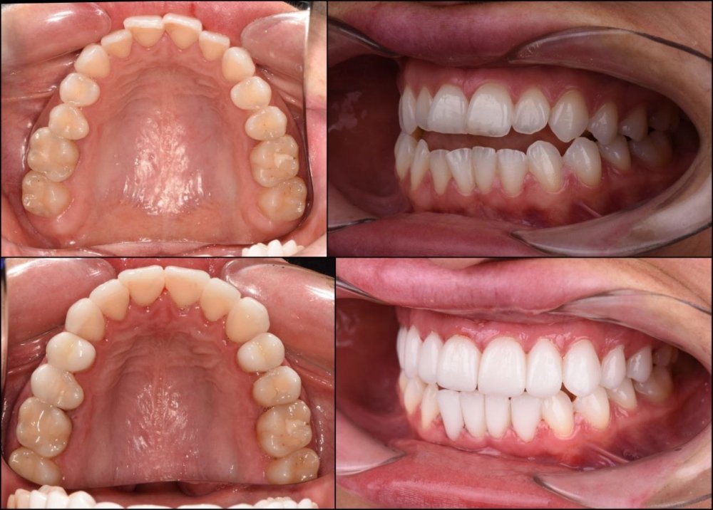 Міфи про вініри