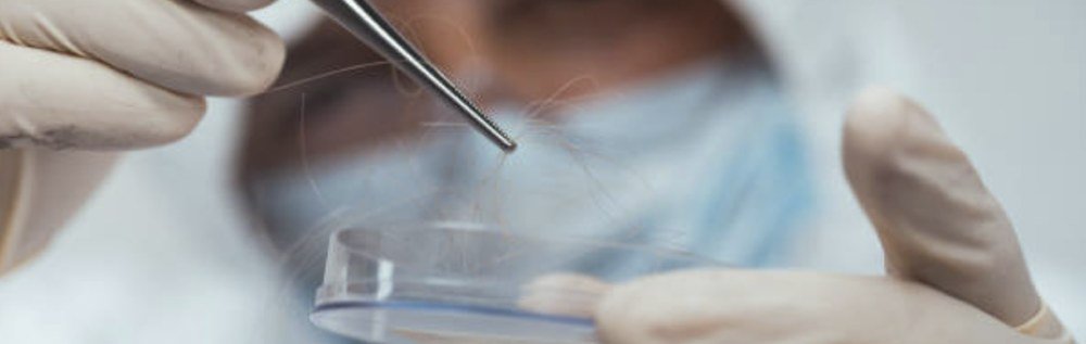 Мікробіологічний аналізатор в дії