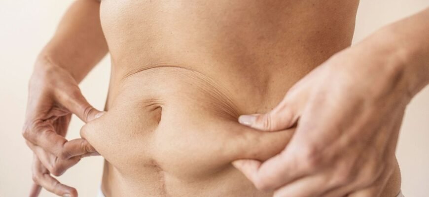 Пластика живота: досягніть ідеальної фігури мрії після вагітності чи схуднення