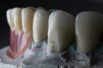 Сучасний лазерний метод відновлення зубів: ефективність та безпечність