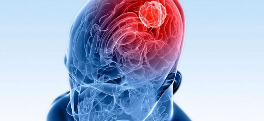 Симптоми енцефаліту: як розпізнати хворобу та діагностувати її