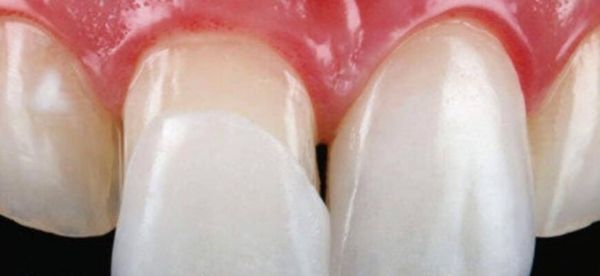 Міфи про вініри: Розвінчуємо стереотипи та відкриваємо правду