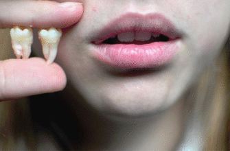 Значення сну: видалення зуба уві сні та його символіка в житті