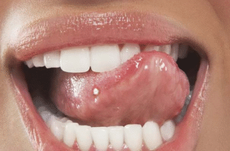 Прищ на язиці: розкриття народних прикмет та їх значення для вас