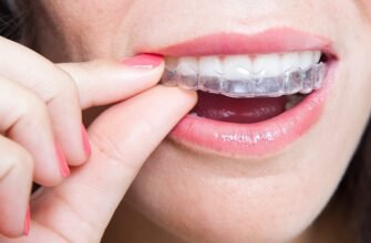 Ефективні капи від бруксизму: захистіть свої зуби від стирання