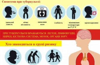 Найкращий захист від туберкульозу: ефективні методи профілактики