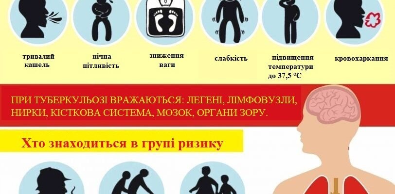 Найкращий захист від туберкульозу: ефективні методи профілактики