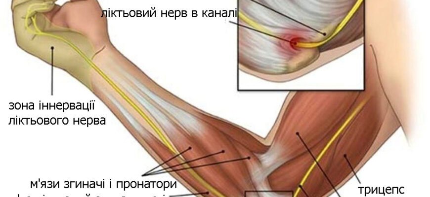Причини болю в лікті: від травм до захворювань суглобів і нервів